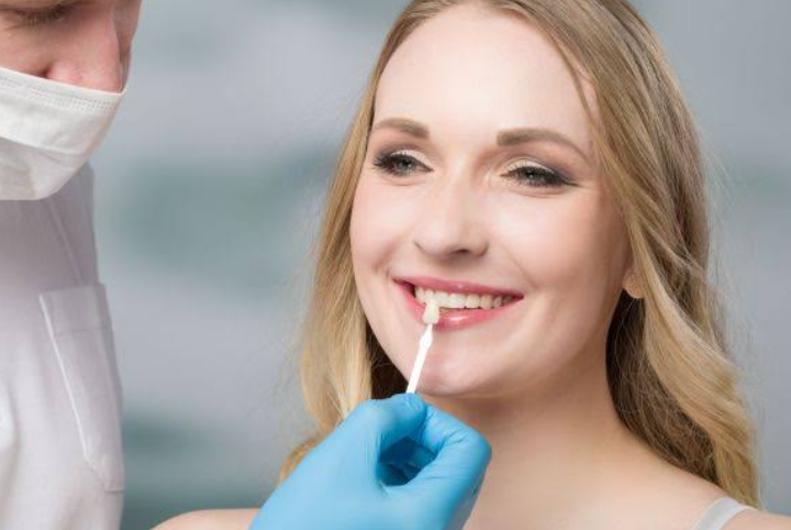5 Questions Families Ask Most About Veneers And Dental Bonding