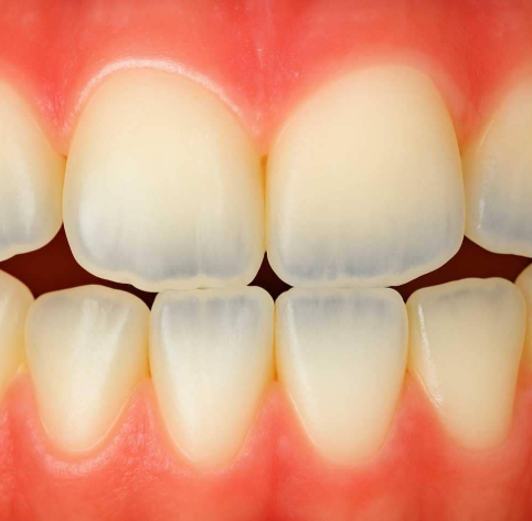 5 Factors That Determine Whether Enamel Changes Need Treatment