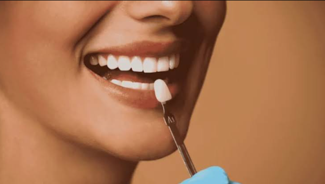 Why Preventive Dentistry Is Essential Before Bonding, Veneers, Or Whitening